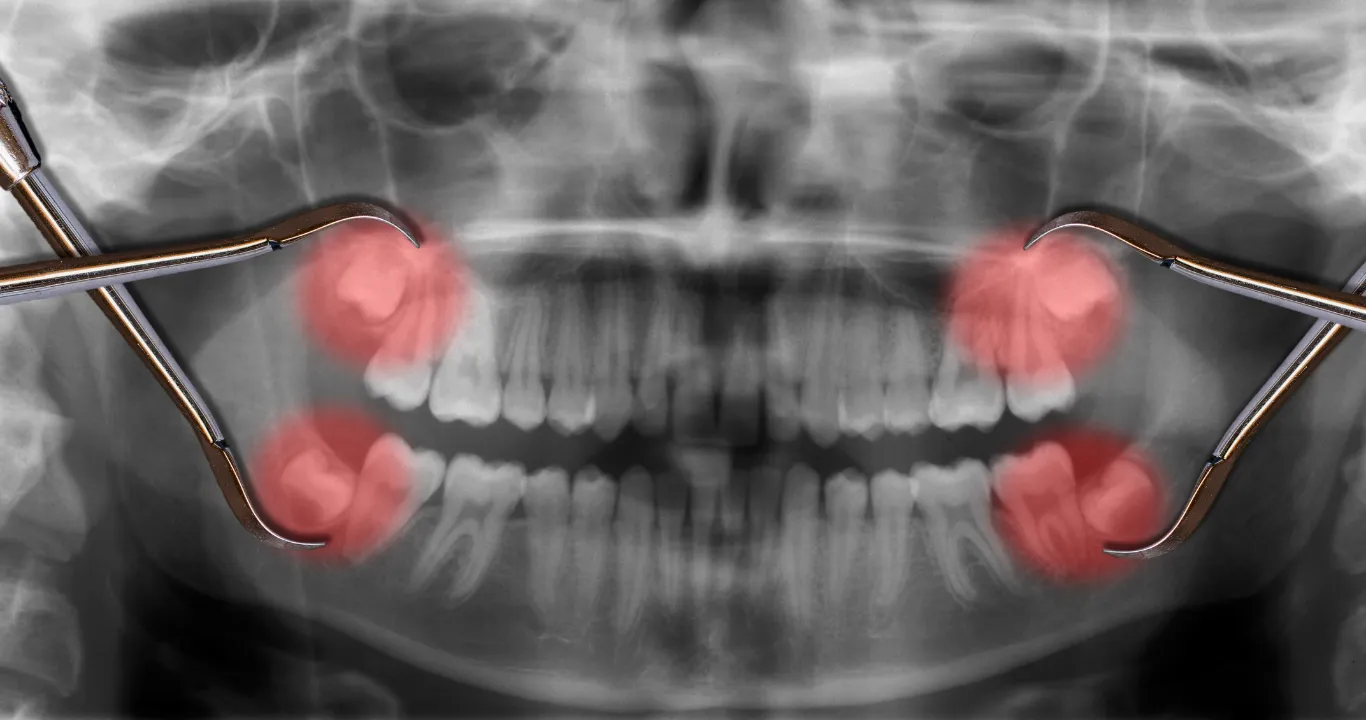 Dental Surgeries